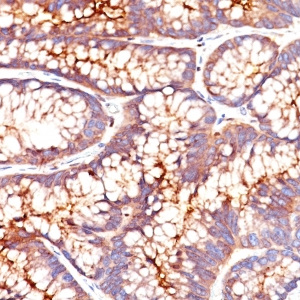 Carcinoembryonic Antigen (CEA) / CD66 ; Clone SPM541 (Concentrate)